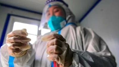 Mpox em alerta global: OMS descarta lockdowns, mas reforça medidas preventivas — 562