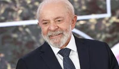 Lula passa por cirurgia em São Paulo para drenagem de hematoma — 56