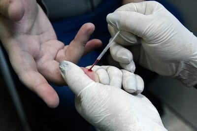 Prefeitura reforça ações de combate no Dia Mundial de Luta Contra as Hepatites Virais — 503
