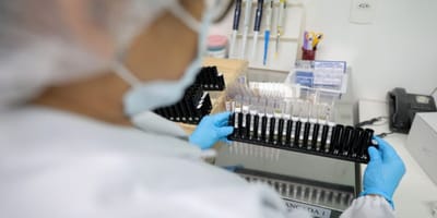 anvisa-autoriza-teste-em-humanos-de-vacina-100-brasileira-contra-malaria — 33