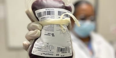 ministerio-da-saude-aprova-protocolo-para-tratar-criancas-com-hemofilia-a — 17