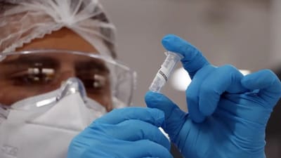 Descoberta do Novo Coronavírus HKU5-CoV-2 na China: OMS Faz Alerta sobre Vigilância em 20/02/2025