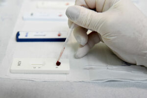 Prefeitura reforça ações de combate no Dia Mundial de Luta Contra as Hepatites Virais